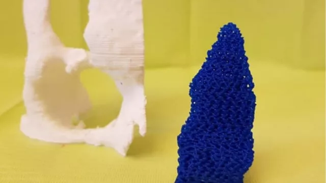 Orgullo tucumano: crean “huesos” a medida y con impresoras 3D